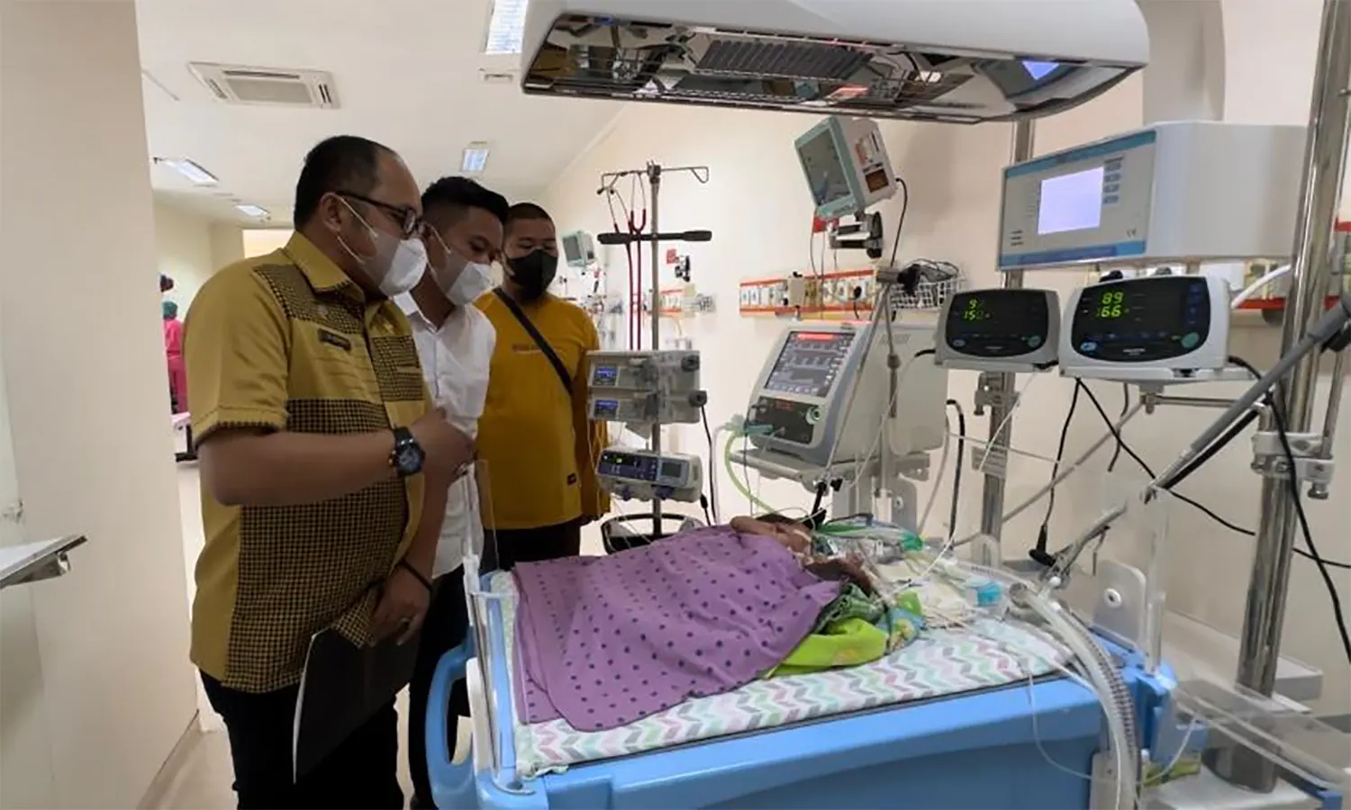 Bayi Kembar Siam Dempet Dada di Medan Meninggal Dunia