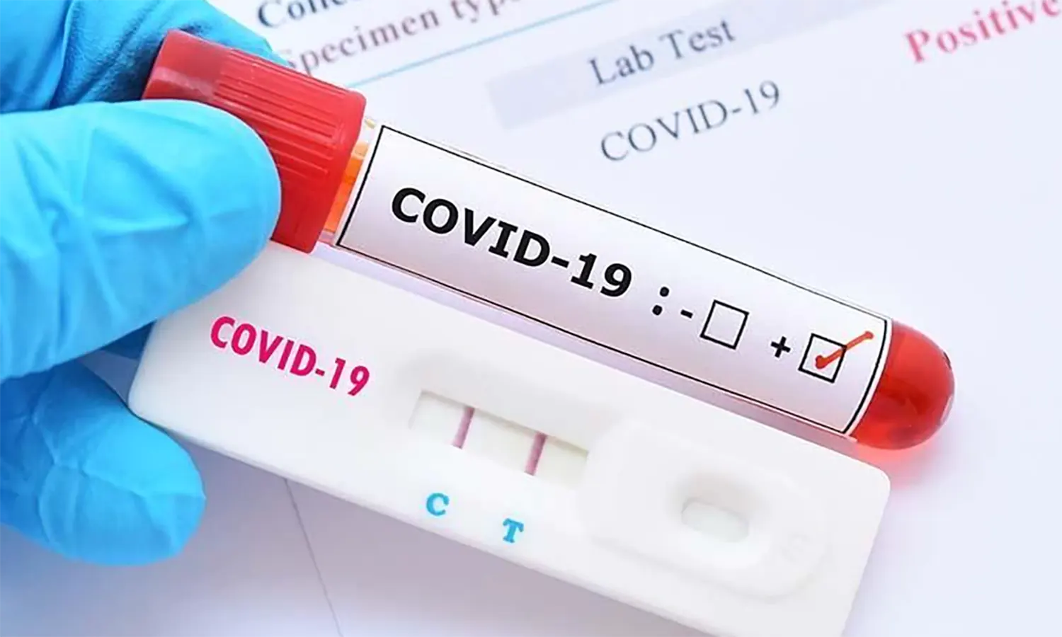 Kasus Positif Covid-19 di Indonesia Bertambah 1.915 pada 28 September 2022